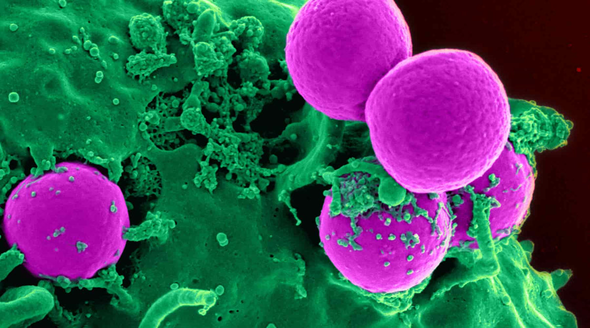 Scanning electron microscope image of neutrophil engulfing bacteria